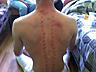Мышечная коррекция - глубокий точечный массаж мышц спины