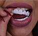 Виниры на зубы Perfect Smile Veneers