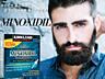 Minoxidil solutie pentru par