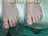 Мед. педикюр, подолог