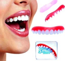 Perfect Smile Veneers - съемные виниры