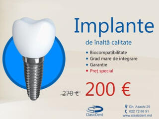 Ofertă specială! Implantarea dintilor in Chisinau 200 Euro ClasicDent