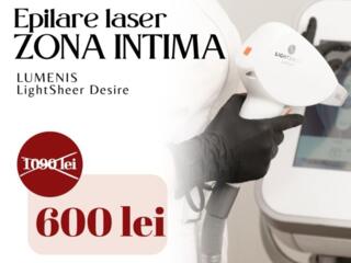 Ofertă Limitată epilare laser inghinală la doar 600 lei