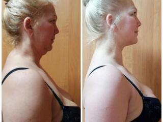 МАССАЖ И ОМОЛОЖЕНИЕ