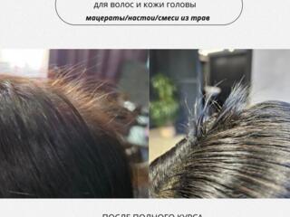 Остановка выпадения волос. Био окрашивание травами