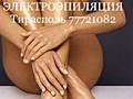Электроэпиляция Тирасполь! 250 руб. /час