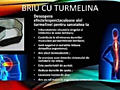 Sănătoase afecțiuni de spate