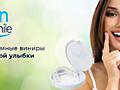 Съемные виниры для зубов Snap-On Smile. Подарите себе идеальную улыбку